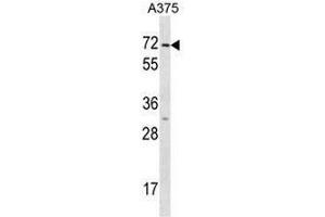 KRT75 Antibody (N-term) western blot analysis in A375 cell line lysates (35µg/lane). (Keratin 75 抗体  (N-Term))