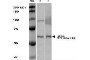 Western Blot analysis of Human A431 and HEK293 cell lysates showing detection of TCP1 alpha protein using Rat Anti-TCP1 alpha Monoclonal Antibody, Clone 23c . (TCP1 alpha/CCTA 抗体  (C-Term) (PE))