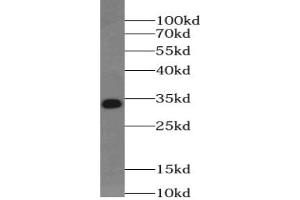 Western blot analysis of Jurkat cells subjected to SDS-PAGE using UCK2 Antibody at a dilution of 1/500. (UCK2 抗体)