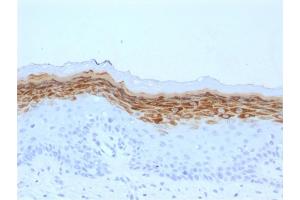 Formalin-fixed, paraffin-embedded human Skin stained with Filaggrin Mouse Monoclonal Antibody (FLG/1561). (Filaggrin 抗体  (AA 198-288))