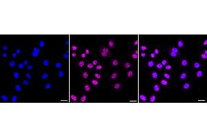 Immunocytochemical staining of HepG2 cells with Mediator complex subunit 4 antibody (ABIN7799350), 1:1,000). (Recombinant Mediator Complex 抗体  (Subunit 4))