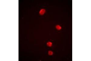 Immunofluorescent analysis of PSMD13 staining in Jurkat cells. (PSMD13 抗体)