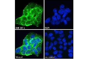 ABIN570961 Immunofluorescence analysis of paraformaldehyde fixed A431 cells, permeabilized with 0. (TJP1 抗体  (Internal Region))