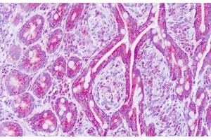 Image no. 2 for anti-Mitochondrial Ribosomal Protein L12 (MRPL12) (AA 87-136) antibody (ABIN6749796) (MRPL12 抗体  (AA 87-136))