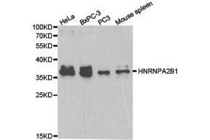 Western Blotting (WB) image for anti-Heterogeneous Nuclear Ribonucleoprotein A2/B1 (HNRNPA2B1) antibody (ABIN1873065) (HNRNPA2B1 抗体)