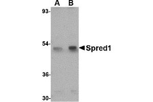 Western Blotting (WB) image for anti-Sprouty-Related, EVH1 Domain Containing 1 (SPRED1) (Middle Region 1) antibody (ABIN1031192) (SPRED1 抗体  (Middle Region 1))