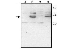 Western Blotting (WB) image for anti-Visual System Homeobox 2 (VSX2) antibody (ABIN293468) (VSX2 抗体)
