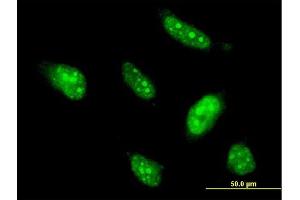 Immunofluorescence of monoclonal antibody to BTG4 on HeLa cell. (BTG4 抗体  (AA 1-206))