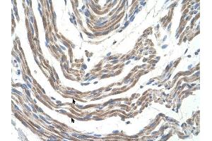 STK11 antibody was used for immunohistochemistry at a concentration of 4-8 ug/ml to stain Skeletal muscle cells (arrows) in Human Muscle. (LKB1 抗体  (N-Term))
