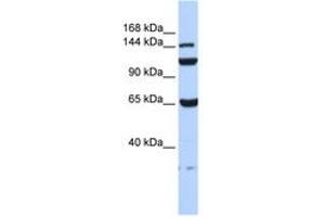 Image no. 1 for anti-Chromosome 17 Open Reading Frame 57 (C17orf57) (AA 72-121) antibody (ABIN6741196) (C17orf57 抗体  (AA 72-121))