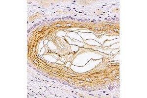 Immunohistochemistry of paraffin embedded rat esophagus using TR2IT1 (ABIN7075887) at dilution of 1:1500 (400x lens) (TXNRD3NB 抗体)