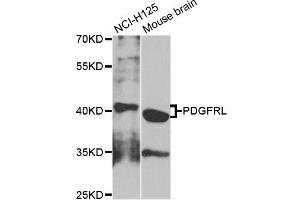 Western blot analysis of extracts of NCI-H125 cells, using PDGFRL antibody (ABIN5995942) at 1/1000 dilution. (PDGFRL 抗体)