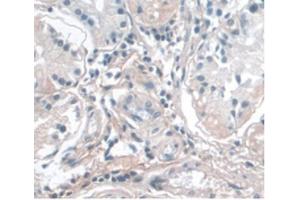 Detection of APOA1 in Human Stomach Tissue using Monoclonal Antibody to Apolipoprotein A1 (APOA1) (APOA1 抗体  (AA 122-267))