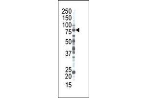 Image no. 1 for anti-Ribophorin II (RPN2) (N-Term) antibody (ABIN357701) (Ribophorin II 抗体  (N-Term))