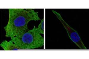 Confocal immunofluorescence analysis of PANC-1 (left) and SKBR-3 (right) cells using SOD1 mouse mAb (green).