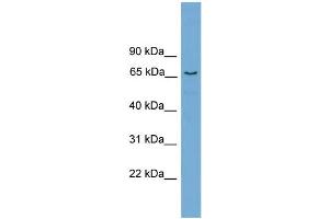 WB Suggested Anti-PPP2R5D Antibody Titration: 0. (PPP2R5D 抗体  (Middle Region))