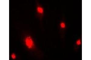 Immunofluorescent analysis of DDB2 staining in MCF7 cells. (DDB2 抗体)