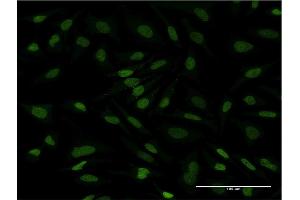 Immunofluorescence of monoclonal antibody to CDC2L6 on HeLa cell. (CDK19 抗体  (AA 1-114))