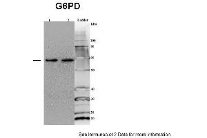 Sample type: 1. (Glucose-6-Phosphate Dehydrogenase 抗体  (Middle Region))