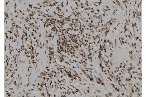 ABIN6274008 at 1/100 staining Human gastric tissue by IHC-P. (DUSP6 抗体  (Internal Region))
