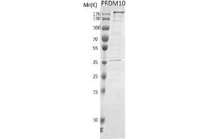 Recombinant PRDM10 protein gel. (PRDM10 Protein (DYKDDDDK Tag))