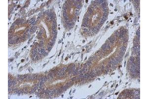 Immunohistochemistry (IHC) image for anti-Superoxide Dismutase 1, Soluble (SOD1) (C-Term) antibody (ABIN2854826)