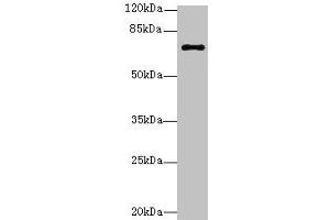 Western blot All lanes: RHOBTB3 antibody at 12 μg/mL + Hela whole cell lysate Secondary Goat polyclonal to rabbit IgG at 1/10000 dilution Predicted band size: 70 kDa Observed band size: 70 kDa (RHOBTB3 抗体  (AA 251-500))