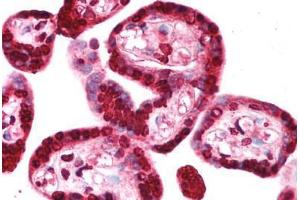 Human Placenta (formalin-fixed, paraffin-embedded) stained with TRIM34 antibody ABIN213722 at 2. (TRIM34 抗体  (AA 49-98))