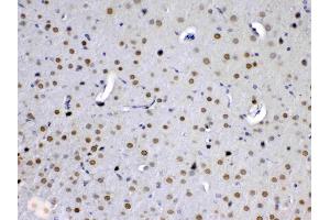 Immunohistochemistry (IHC) image for anti-Mediator Complex Subunit 15 (MED15) (AA 1-285) antibody (ABIN5519035)