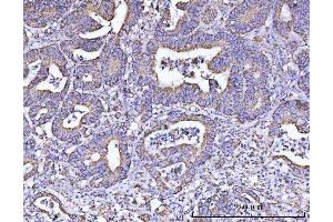 IHC analysis of ATP5F1B using anti-ATP5F1B antibody (ABIN7599866). (Atp5f1b (AA 123-529) 抗体)