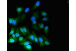 Immunofluorescent analysis of Hela cells using ABIN7167074 at dilution of 1:100 and Alexa Fluor 488-congugated AffiniPure Goat Anti-Rabbit IgG(H+L) (RGL2 抗体  (AA 145-328))