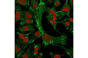 Immunofluorescence Analysis of A549 cells labeling KRT4 with Cytokeratin 4 Mouse Monoclonal Antibody (KRT4/2804)followed by Goat anti-Mouse IgG-CF488 (Green). (KRT4 抗体  (AA 181-292))