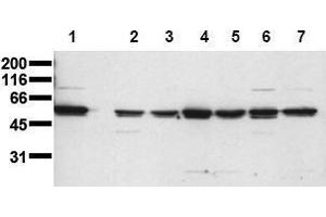 Western Blotting (WB) image for anti-V-Yes-1 Yamaguchi Sarcoma Viral Oncogene Homolog 1 (YES1) (N-Term) antibody (ABIN126915)