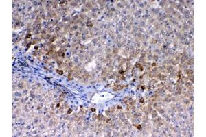 IHC testing of FFPE rat liver tissue with CD105 antibody at 1ug/ml. (Endoglin 抗体)