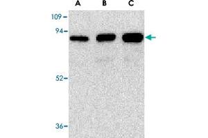 Western blot analysis of (A) 25 ng, (B) 50 ng, and (C) 100 ng of purified recombinant NGFR with NGFR polyclonal antibody  at 1 ug/mL . (NGFR 抗体)