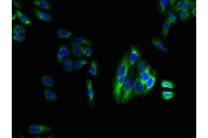 Immunofluorescent analysis of HepG2 cells using ABIN7158748 at dilution of 1:100 and Alexa Fluor 488-congugated AffiniPure Goat Anti-Rabbit IgG(H+L) (LPAR4 抗体  (AA 1-43))