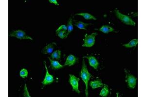 Immunofluorescence (IF) image for anti-Glial Fibrillary Acidic Protein (GFAP) (AA 292-432) antibody (ABIN7153847)