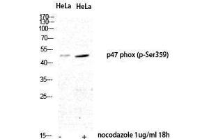 Western Blotting (WB) image for anti-Neutrophil Cytosol Factor 1 (NCF1) (pSer359) antibody (ABIN3182821) (NCF1 抗体  (pSer359))