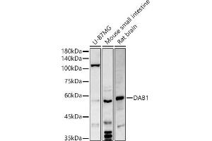 Western blot analysis of extracts of various cell lines, using D antibody (ABIN6130320, ABIN6139385, ABIN6139386 and ABIN6214572) at 1:500 dilution. (DAB1 抗体  (AA 1-185))