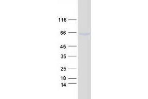 Western Blotting (WB) image for UDP-N-Acetyl-alpha-D-Galactosamine:polypeptide N-Acetylgalactosaminyltransferase 13 (GalNAc-T13) (GALNT13) protein (Myc-DYKDDDDK Tag) (ABIN2721662)