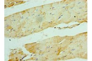 Immunohistochemistry of paraffin-embedded human skeletal muscle tissue using ABIN7175850 at dilution of 1:100 (WISP2 抗体  (AA 1-250))