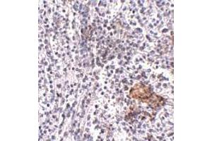 Immunohistochemistry (IHC) image for anti-Leucine-rich repeat protein SHOC-2 (SHOC2) (N-Term) antibody (ABIN1031560) (SHoc2/Sur8 抗体  (N-Term))