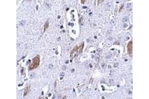 Immunohistochemistry of ATOH8 in mouse brain tissue with this product atOH8 antibody at 5 μg/ml. (ATOH8 抗体  (C-Term))