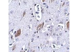 Immunohistochemistry of ATOH8 in mouse brain tissue with this product atOH8 antibody at 5 μg/ml. (ATOH8 抗体  (C-Term))