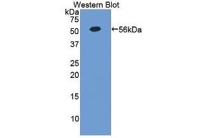 Western Blotting (WB) image for anti-Erythropoietin Receptor (EPOR) (AA 276-496) antibody (ABIN1858733) (EPOR 抗体  (AA 276-496))