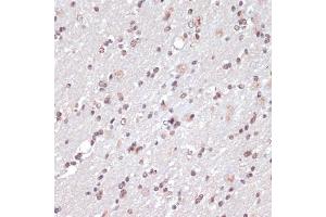 Immunohistochemistry of paraffin-embedded rat brain using c-Jun antibody (ABIN6131074, ABIN6142670, ABIN6142671 and ABIN6215187) at dilution of 1:100 (40x lens). (C-JUN 抗体  (AA 1-70))