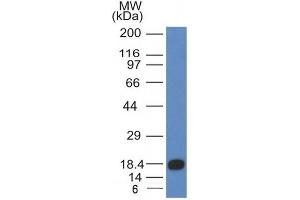 Image no. 1 for anti-Mast/stem Cell Growth Factor Receptor (KIT) (AA 100-300) antibody (ABIN6190789) (KIT 抗体  (AA 100-300))