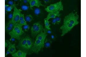 Immunofluorescence (IF) image for anti-Insulin-Like Growth Factor 2 mRNA Binding Protein 2 (IGF2BP2) antibody (ABIN1498825)