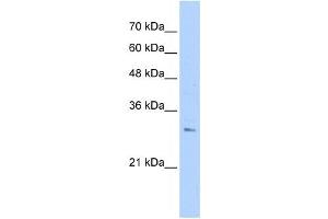 RHBDL2 antibody used at 1 ug/ml to detect target protein. (RHBDL2 抗体)