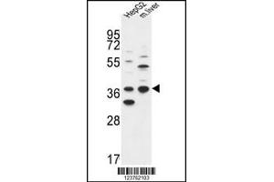 Western blot analysis in HepG2 cell line and mouse liver tissue lysates (35ug/lane). (DHRS3 抗体  (AA 85-113))